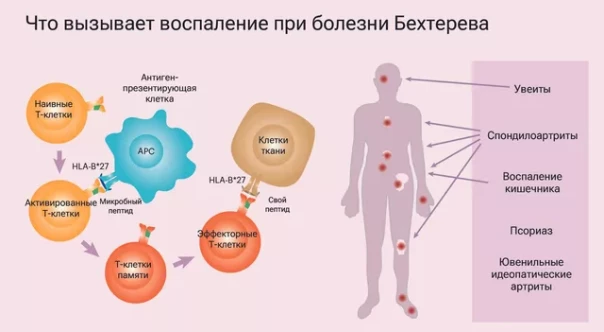 Рискнул здоровьем. Ученый испытал на себе препарат от неизлечимой болезни